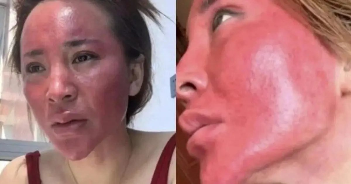 22 Yıldır Makyajını Silmeyen Kadının Yüzü Değişim Geçirdi