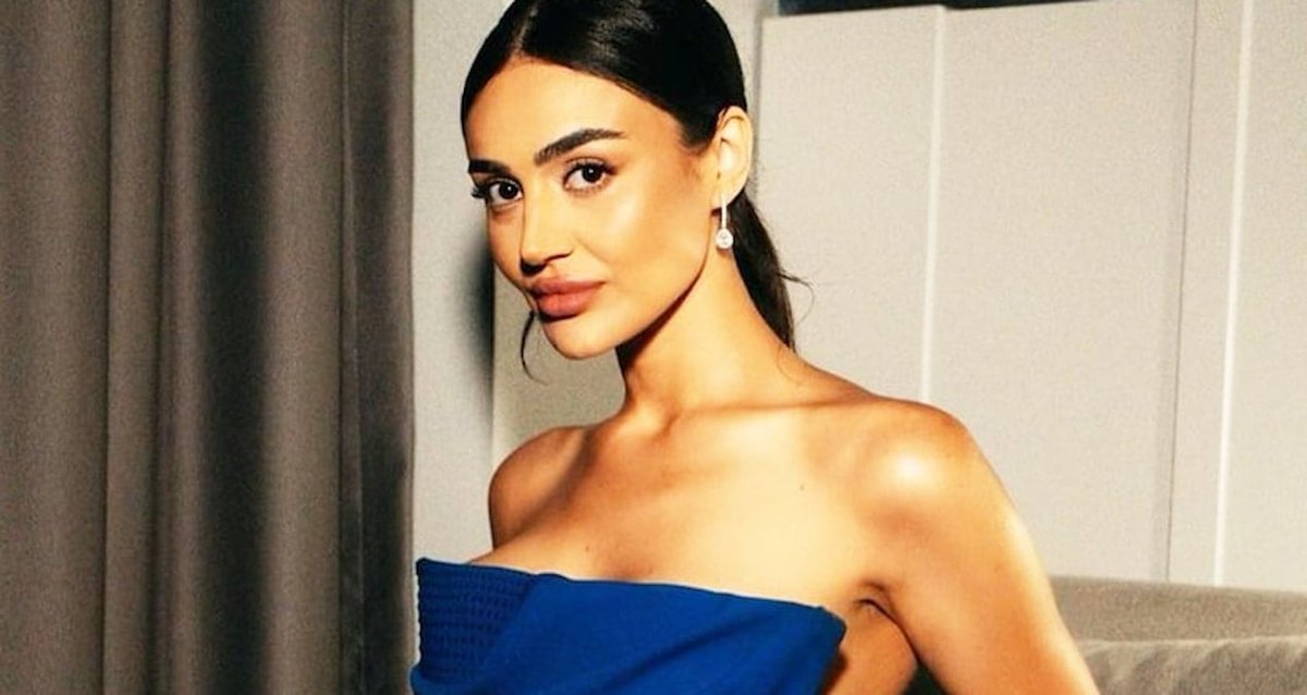 Elif Buse Doğan'ın Vücudu Morarmalarla Dolu Hale Geldi