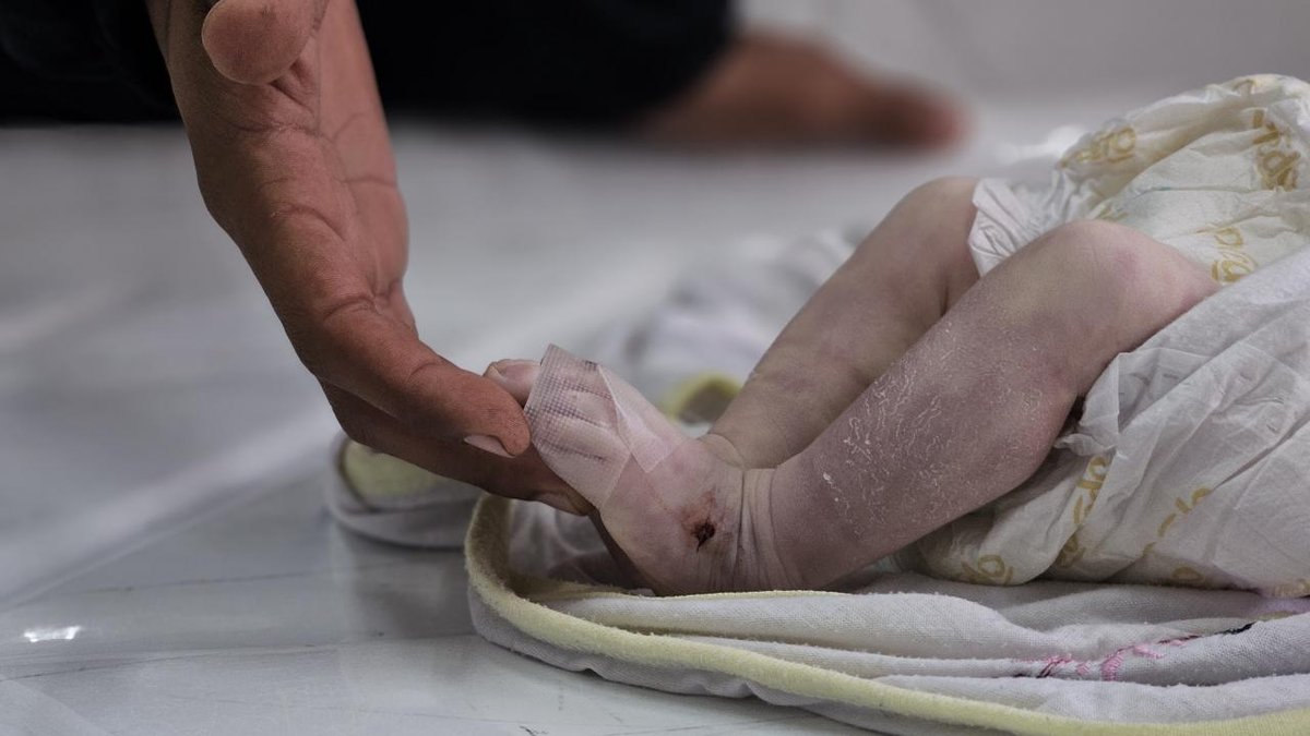 Gazze'deki Soğuk Hava Ve Çevre Kirliliği, 6 Aylık Bebek İçin Felaket Oldu