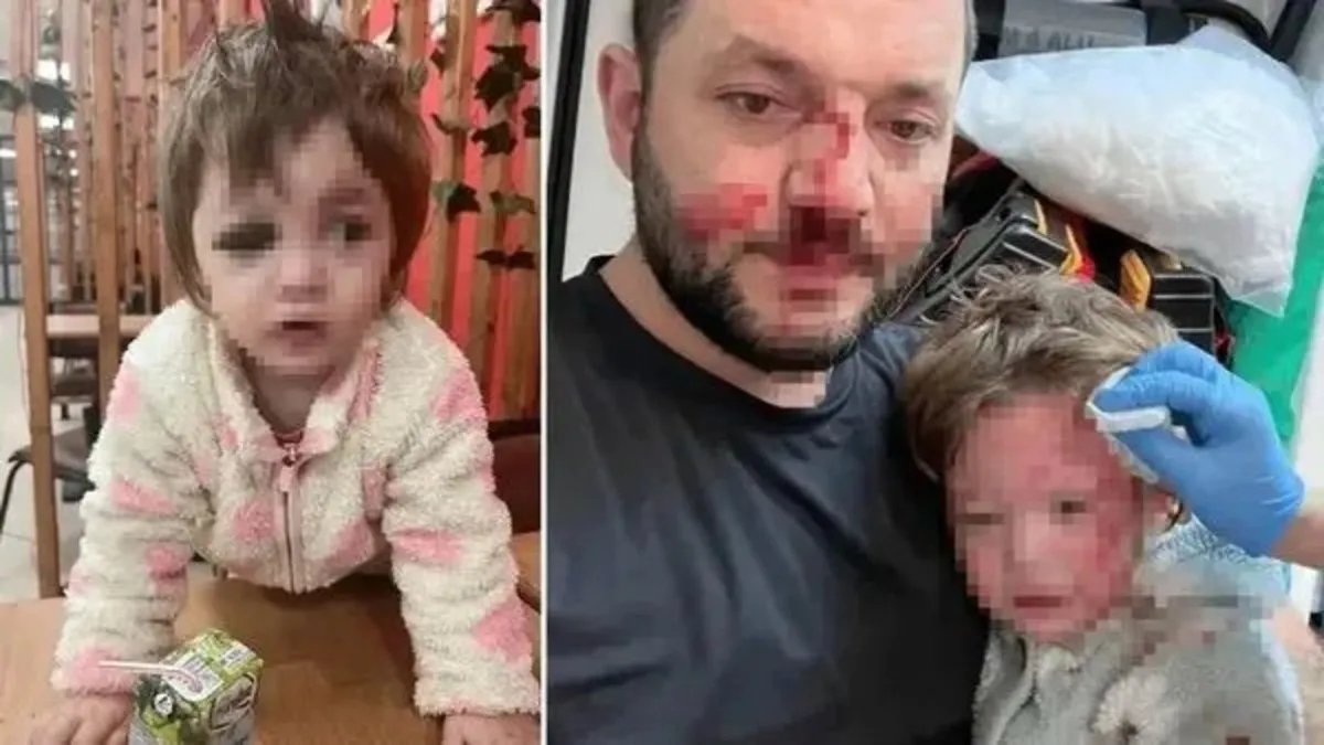 Yalova'da Şiddet Olayı: Baba Kızına Scooter İle Saldırı! Caniye Talep Edilen Ceza…