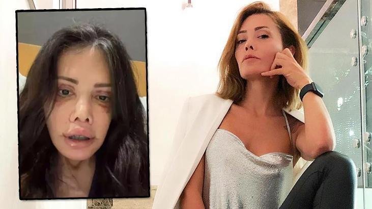 Didem Ceran'dan Şaşırtan Paylaşım: Yüz Nakli Olan Kişinin Alnı!