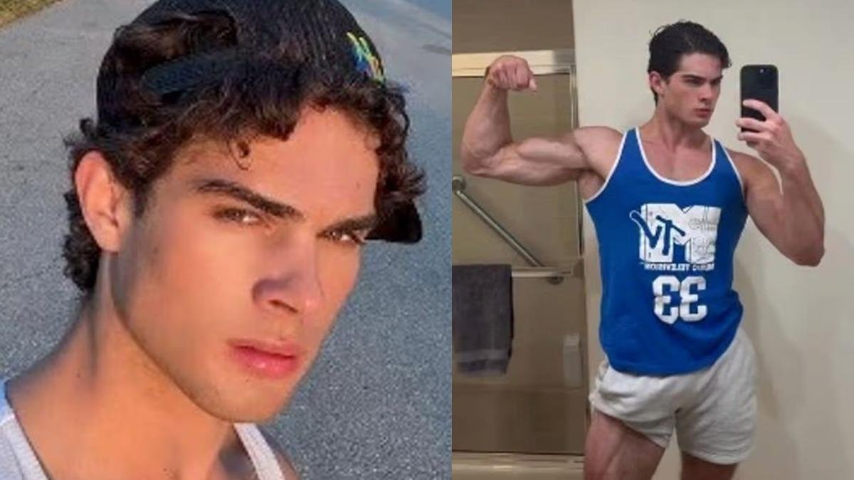 Güzellik İçin Çenesine Çekiçle Vurdu! Başka Yöntemler Denedi