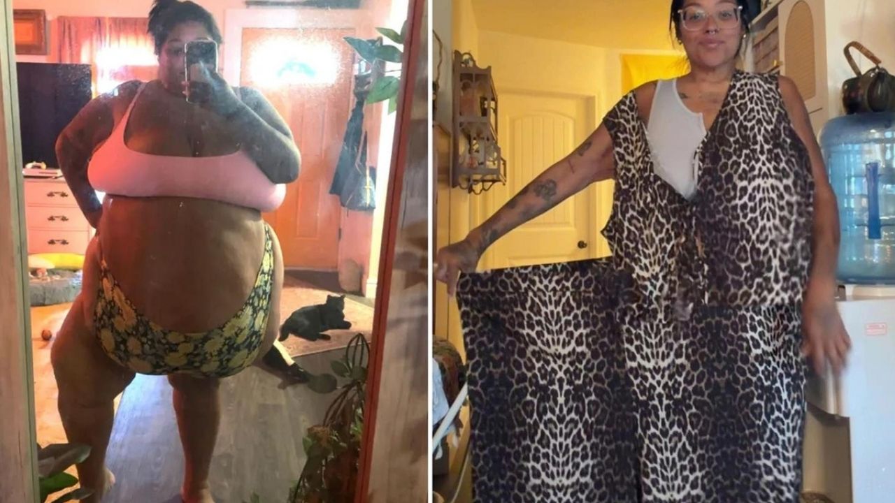 143 Kilo Verdi, 15 Yıl Sonra Hayalini Gerçekleştirdi