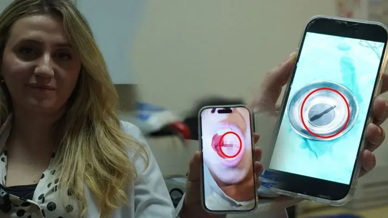 10 Yaşındaki Çocuğun Boğazından Canlı Sülük Çıkarıldı