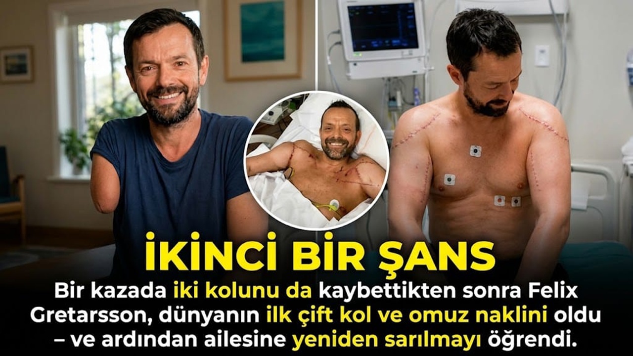 11 Bin Volt Sonrası Tarihe Geçti! Felix Grétarsson’un Çift Kol ve Omuz Nakli Hikâyesi