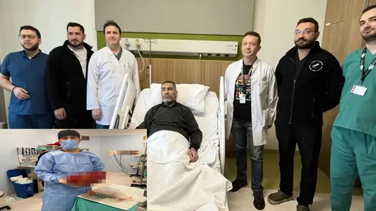 Gaziantep'te 8 Kiloluk Böbrek Ameliyatla Alındı, Doktorlar Gözlerine İnanamadı