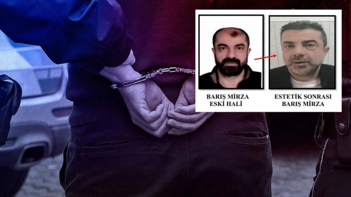 Cinayet Zanlısı Estetik Operasyonlarla Kimliğini Değiştirdi, 7 Yıl Sonra Yakalandı